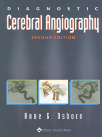 Diagnostic Cerebral Angiography