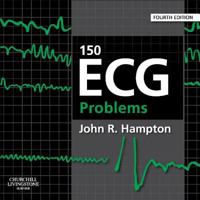 150 ECG Problems