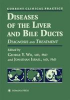 Diseases of the liver and bile ducts