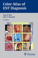 Color Atlas of ENT Diagnosis