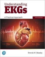 Understanding EKGs: A Practical Approach