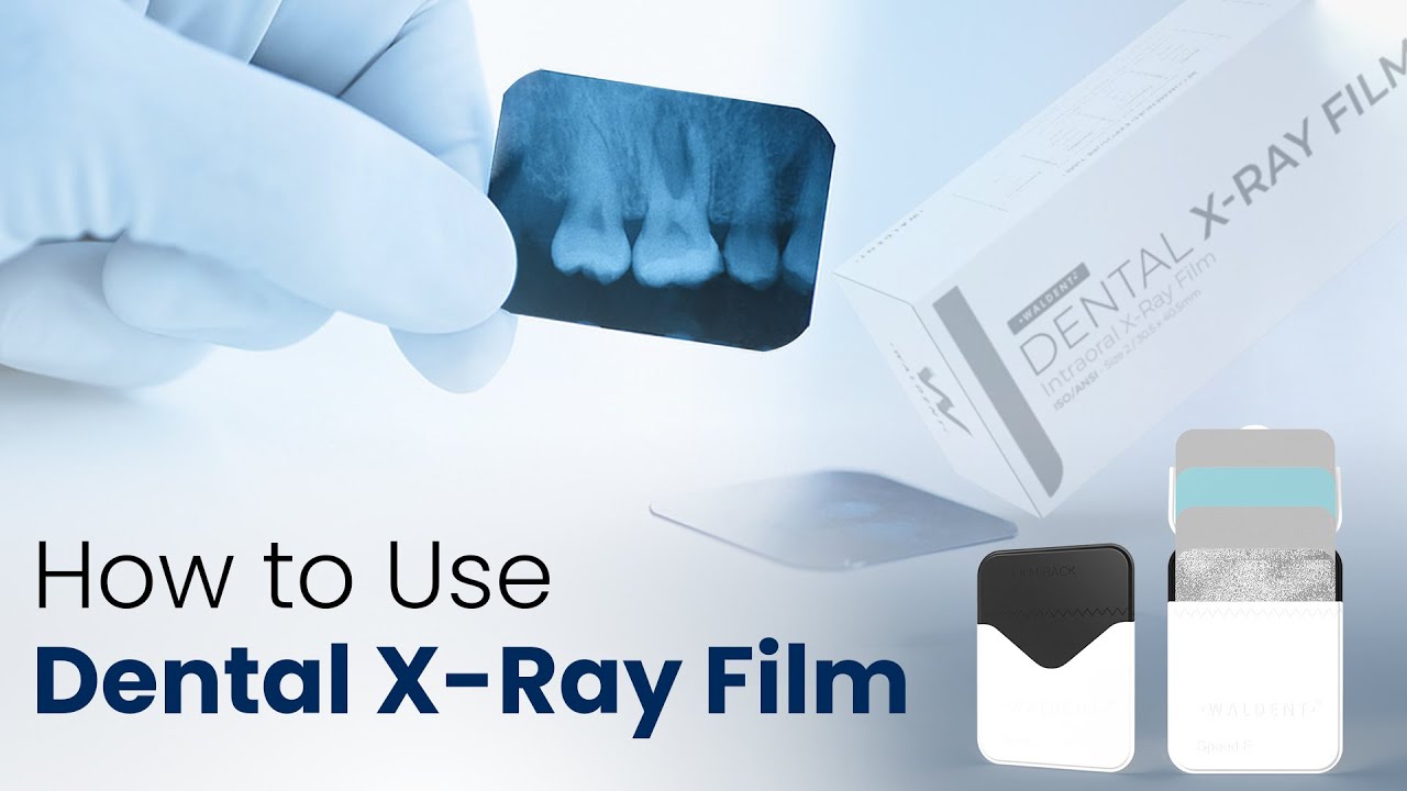 How To Scan Dental X Ray Film? Update - Abettes-culinary.com