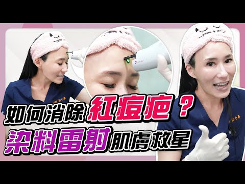 長痘痘怎麽辦？「染料雷射」有效治療痘疤 | 光澤診所 DR.SHINE