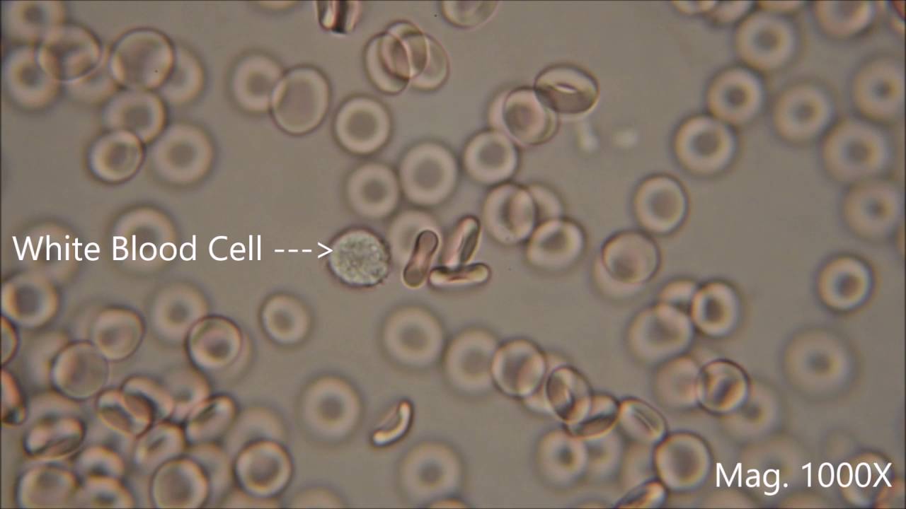 Red blood cells under the microscope, hypo and hypertonic solutions ...