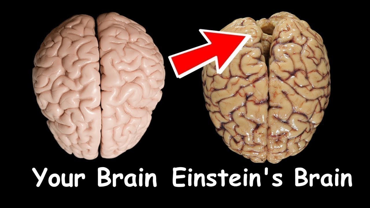 Albert Einstein The Unique Brain - vrogue.co