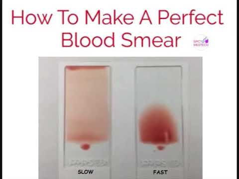 Manual Blood Smears Slides