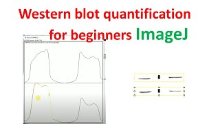 Quantification of western blot using imageJ for beginne... | Doovi