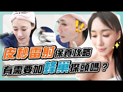 「皮秒」VS「蜂巢皮秒」差在哪？選對療程 | 光澤診所 DR.SHINE