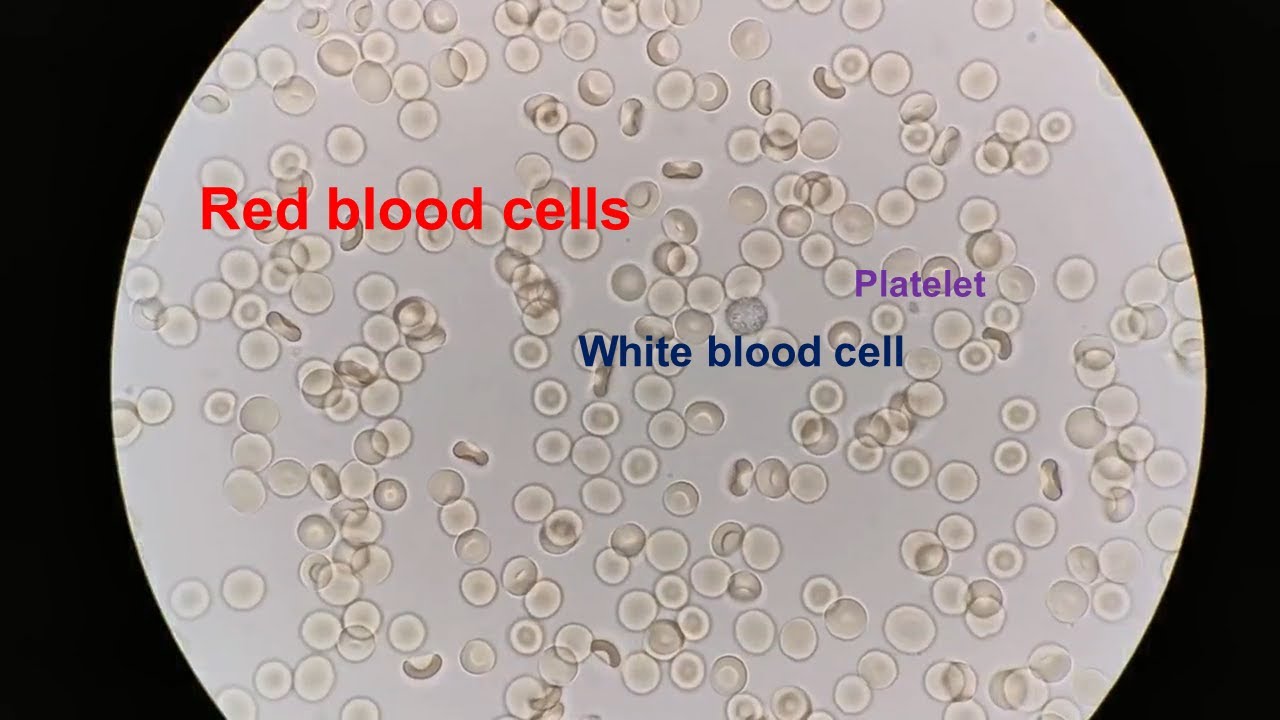 Human Blood Cells Under A Microscope