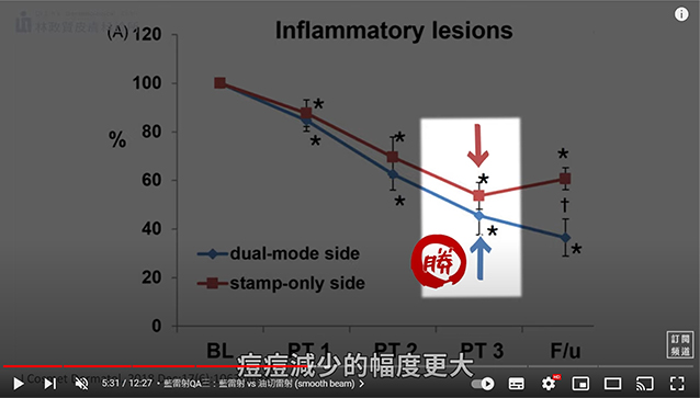 楊省三醫師,痘痘,紅光光動力,藍雷射,油擊手,控油抗痘