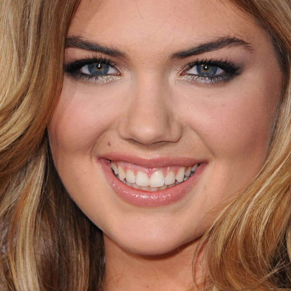 Kate Upton