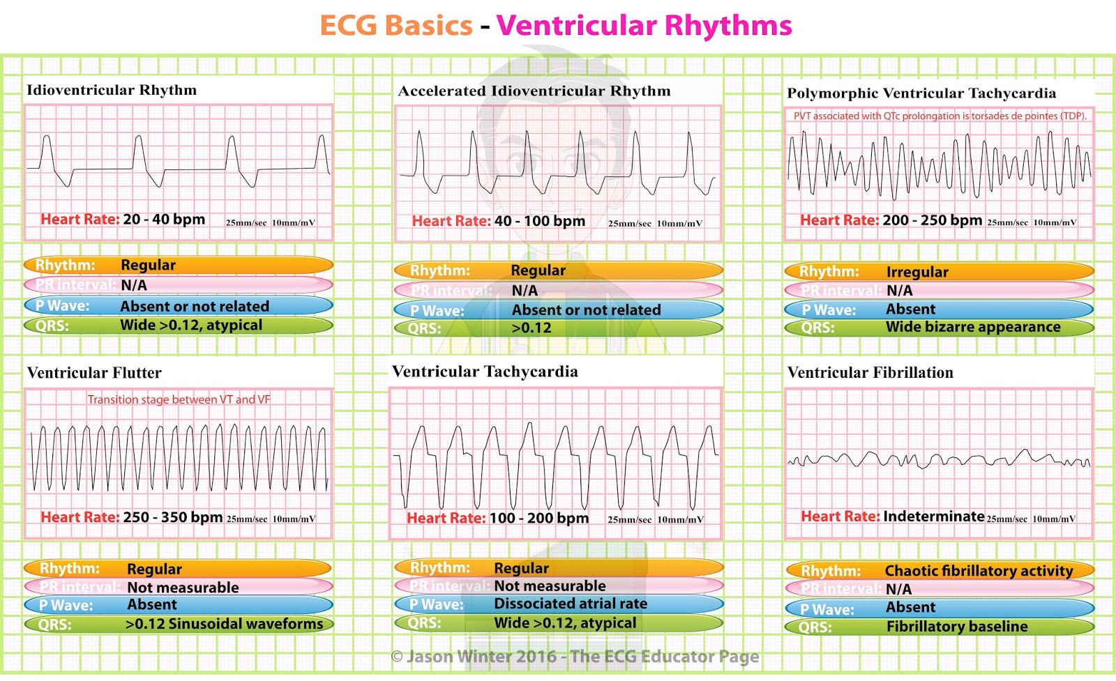 ACLS Rhythms Practice Test 2020 Recognition Rhythm Strips [PDF]