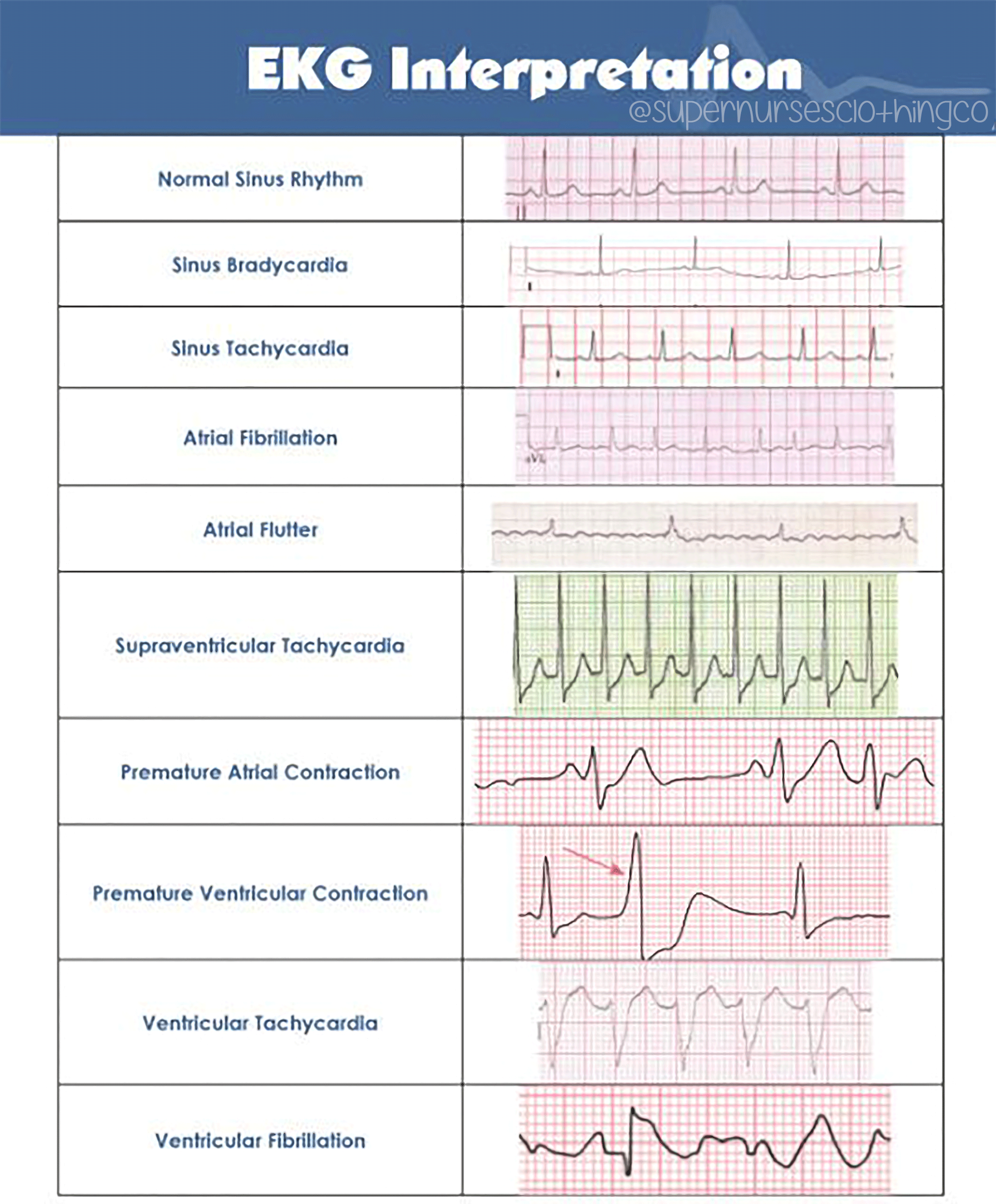 EKG Training, Practice Drills and Quiz Practical Clinical Skills