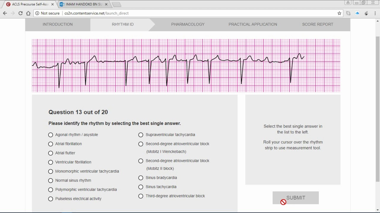 EKG Practice Test [2023] EKG Practice Strips Test-Guide