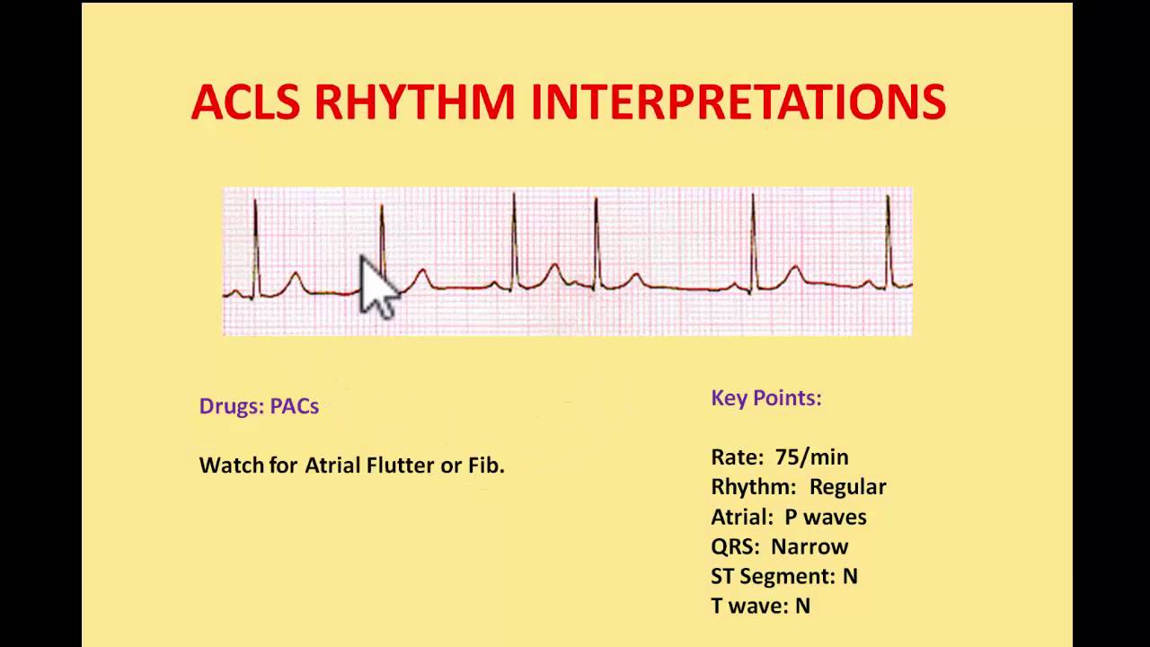 EKG Practice