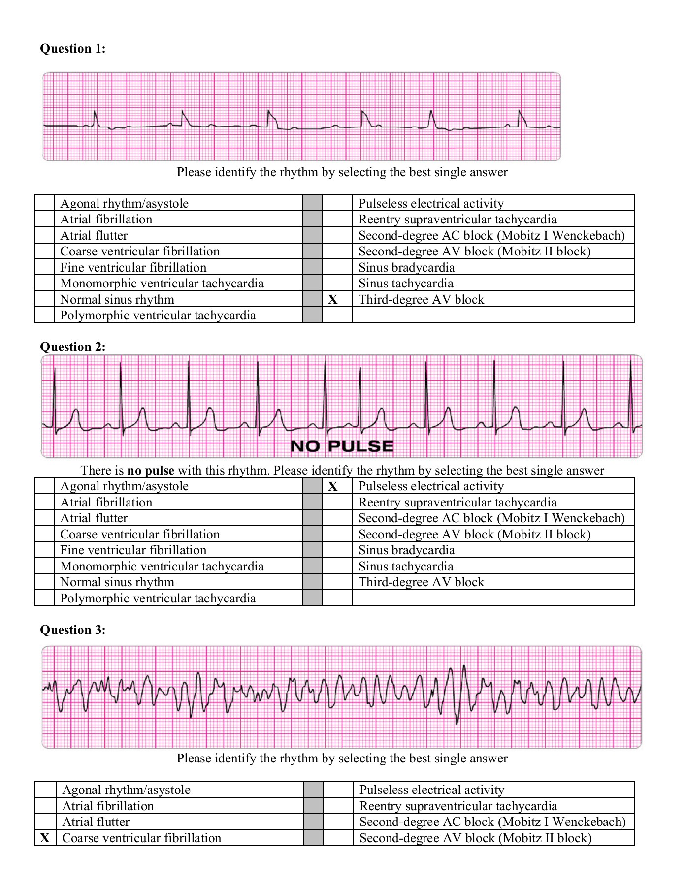 EKG Practice Test 1 Learn & Master ACLS/PALS