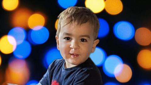 Male toddler with big brown eyes and brown hair, smiling into the camera. He was born with a cleft lip and affected palette. 