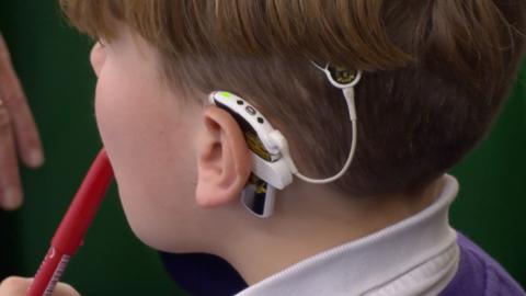 A pupil with a cochlear implant at St Margaret's Academy