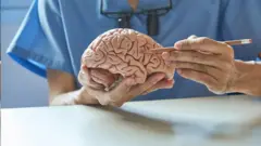 Un médico sosteniendo un cerebro