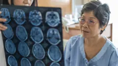 patient who has had a brain scan