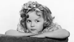 Shirley Temple olhando de lado em foto em preto e branco enquanto apoia seu queixo sobre as mãos