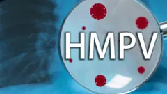 HMPV 