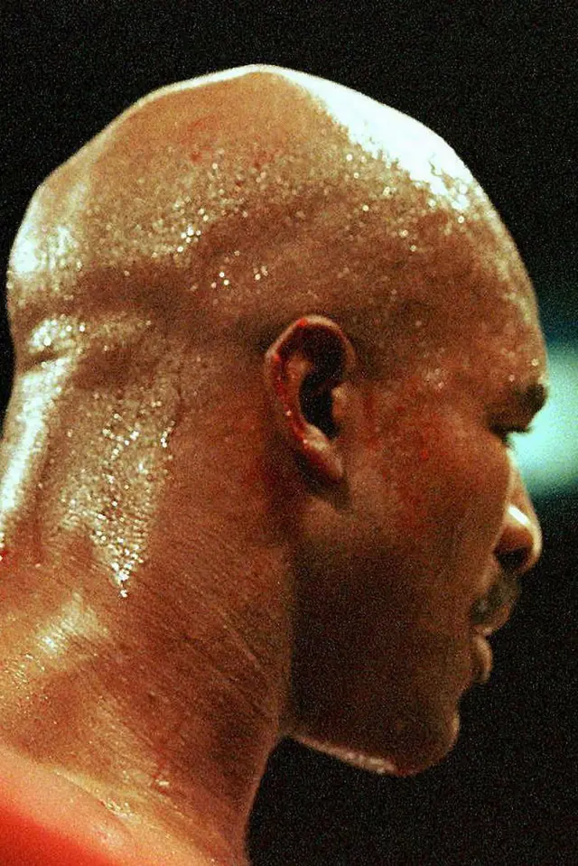 Orelha de Evander Holyfield sangrando após ser mordida durante luta 