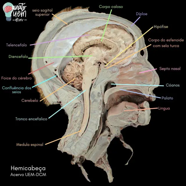 Montagem de crânio dissecado feito por alunos da Universidade Estadual de Maringá