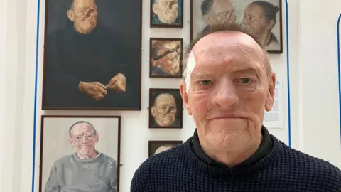 A man wearing a navy blue jumper and with a white plaster on the right side of his face above the eye stands in front of a wall of pictures. Behind him are two portraits, one of the man without his facial prosthesis and one with. There are five smaller portraits of the man.