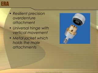 ERA
• Resilient precision
overdenture
attachment
• Universal hinge with
vertical movement
• Metal jacket which
holds the male
attachments
www.indiandentalacademy.com
 