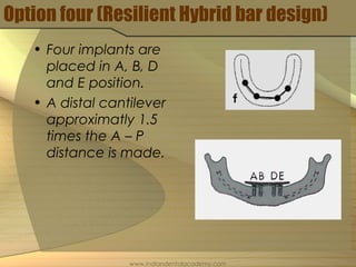 Option four (Resilient Hybrid bar design)
• Four implants are
placed in A, B, D
and E position.
• A distal cantilever
approximatly 1.5
times the A – P
distance is made.
www.indiandentalacademy.com
 