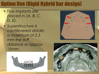 Option five (Rigid Hybrid bar design)
• Five implants are
placed in (A, B, C,
D, E).
• Superstructure is
cantilevered distally
a maximum of 2.5
mm the A-P
distance or approx
15mm.
www.indiandentalacademy.com
 