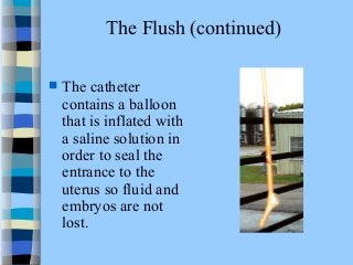 The Flush (continued) 
 The catheter 
contains a balloon 
that is inflated with 
a saline solution in 
order to seal the 
entrance to the 
uterus so fluid and 
embryos are not 
lost. 
 