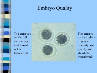 Embryo Quality 
The embryos 
on the left 
are damaged 
and should 
not be 
transferred. 
The embryo 
on the right is 
of proper 
maturity and 
quality and 
should be 
transferred. 
 