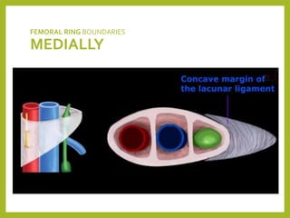 FEMORAL RING BOUNDARIES
MEDIALLY
 