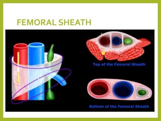 FEMORAL SHEATH
 