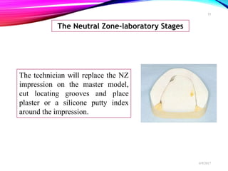 The Neutral Zone-laboratory Stages
The technician will replace the NZ
impression on the master model,
cut locating grooves and place
plaster or a silicone putty index
around the impression.
6/9/2017
35
 