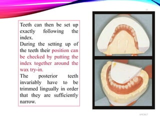 Teeth can then be set up
exactly following the
index.
During the setting up of
the teeth their position can
be checked by putting the
index together around the
wax try-in.
The posterior teeth
invariably have to be
trimmed lingually in order
that they are sufficiently
narrow.
6/9/2017
37
 