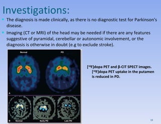 Investigations: The diagnosis is made clinically, as there is no diagnostic test for Parkinson's disease.  Imaging (CT or MRI) of the head may be needed if there are any features suggestive of pyramidal, cerebellar or autonomic involvement, or the diagnosis is otherwise in doubt (e.g to exclude stroke).  [ 18 F]dopa PET and β-CIT SPECT images. [ 18 F]dopa PET uptake in the putamen is reduced in PD. 