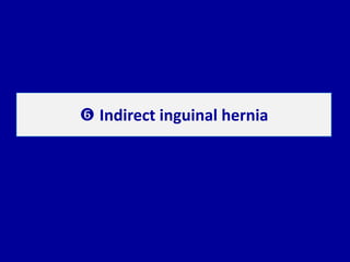  Indirect inguinal hernia
 