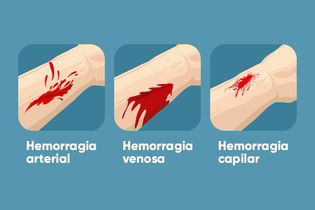 Imagem ilustrativa do artigo Hemorragia: o que é, sintomas, principais tipos (e o que fazer)