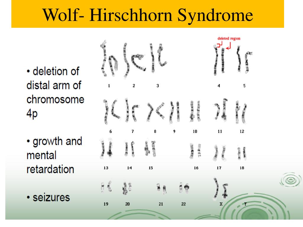 Синдром вольфа хиршхорна презентация
