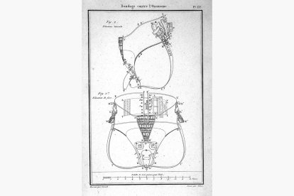 Corsé diseñado para prevenir la masturbación masculina según Guillaume Jalade-Lafond Wellcome Collection. Fuente: Wikicommons