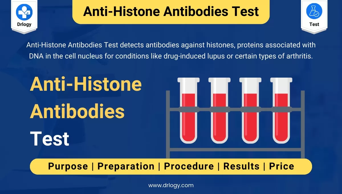 Anti-Histone Antibodies Test For Lupus and Types of Arthritis