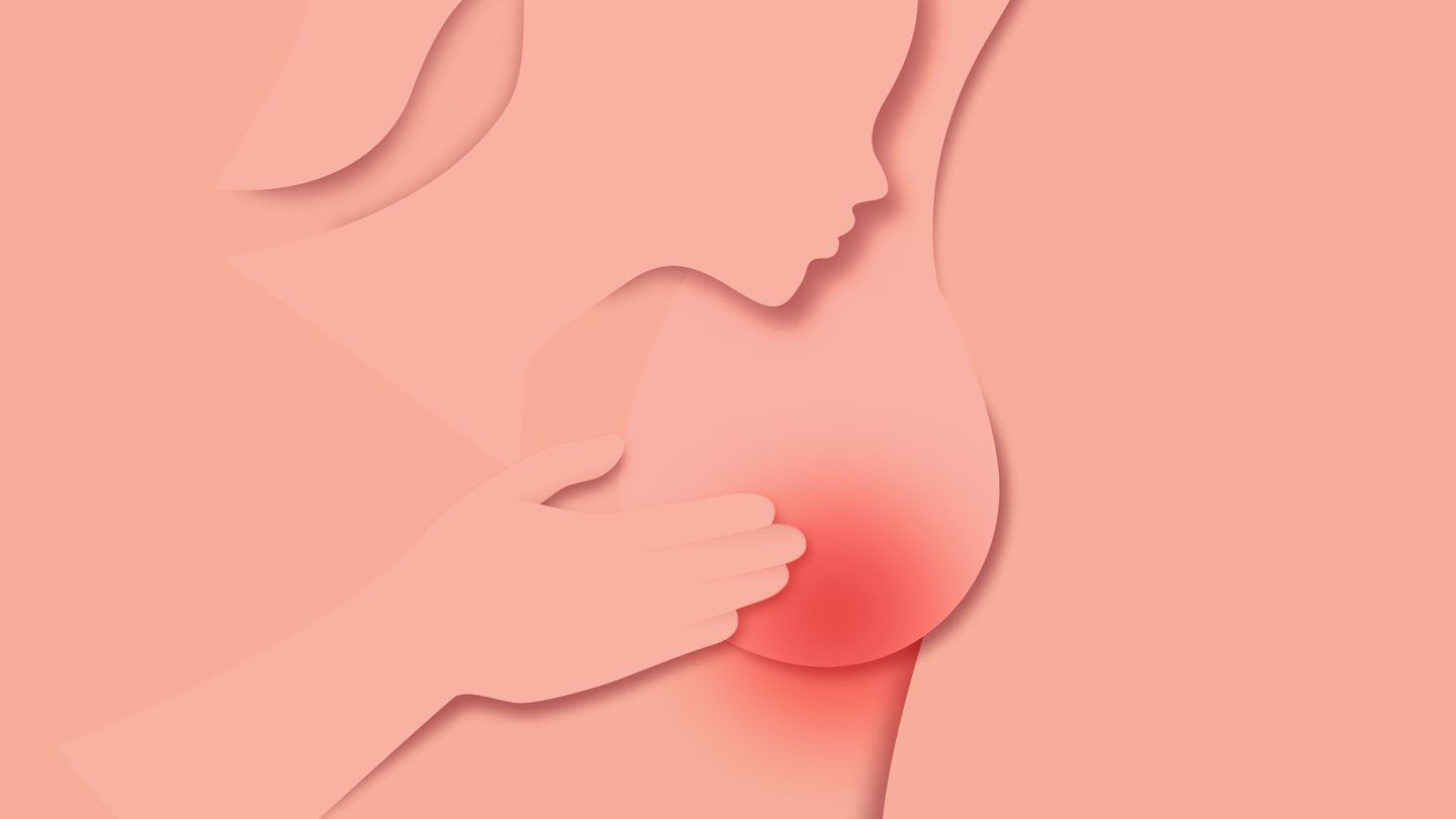 illustration of a woman with a rash on breast