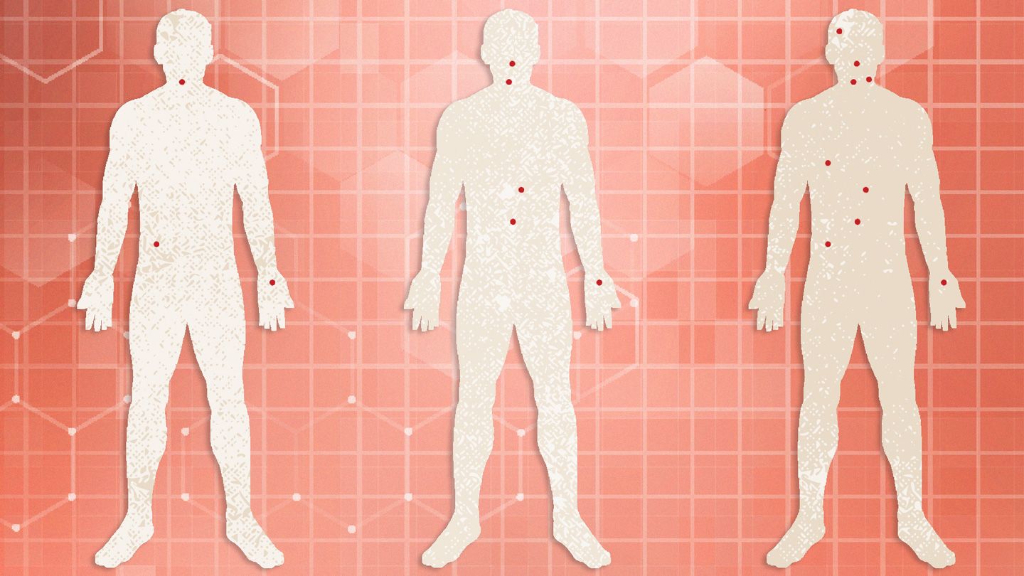 A-Timeline-of-HIV-Symptoms-1440x810