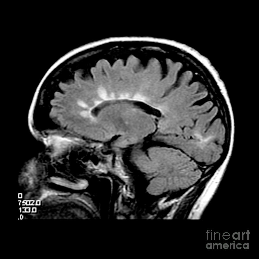 รายการ 93+ ภาพ ภาพ mri สมอง อัปเดต