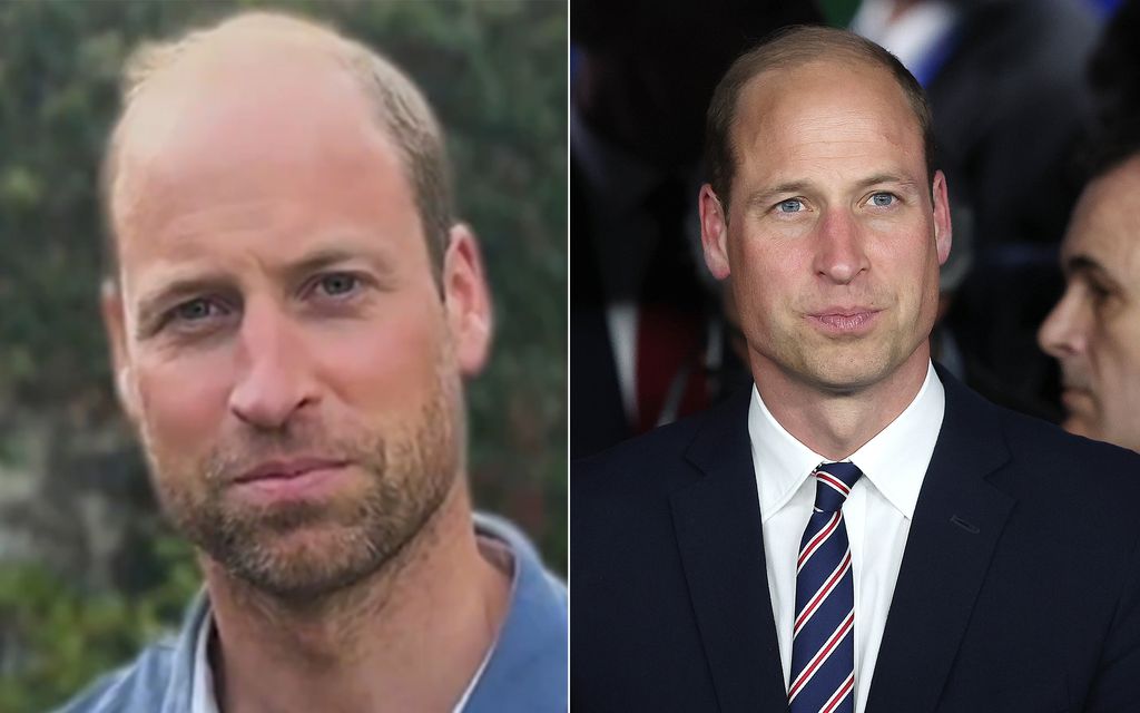 Prince William with stubble (left) and clean-shaven (right)