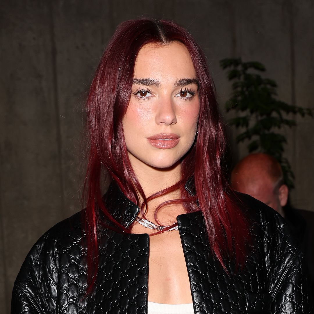 Dua Lipa showcases her legs covered with bruises in new photo