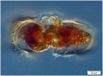 Conjugating pair of Acanthostomella norvegica, author: Dolan, John